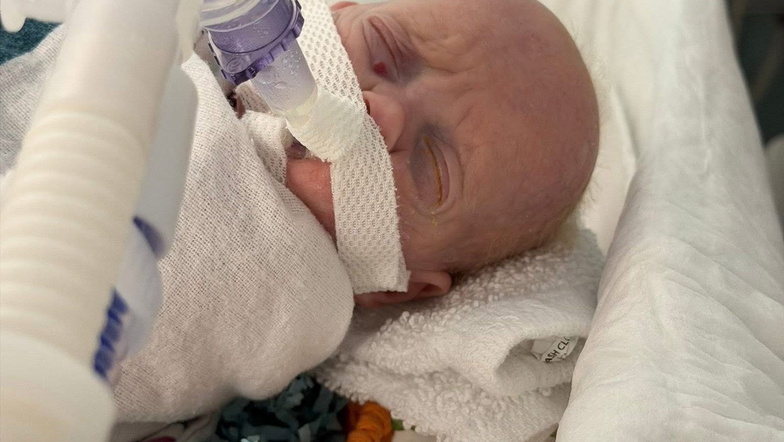 Hope for Baby Axel's journey