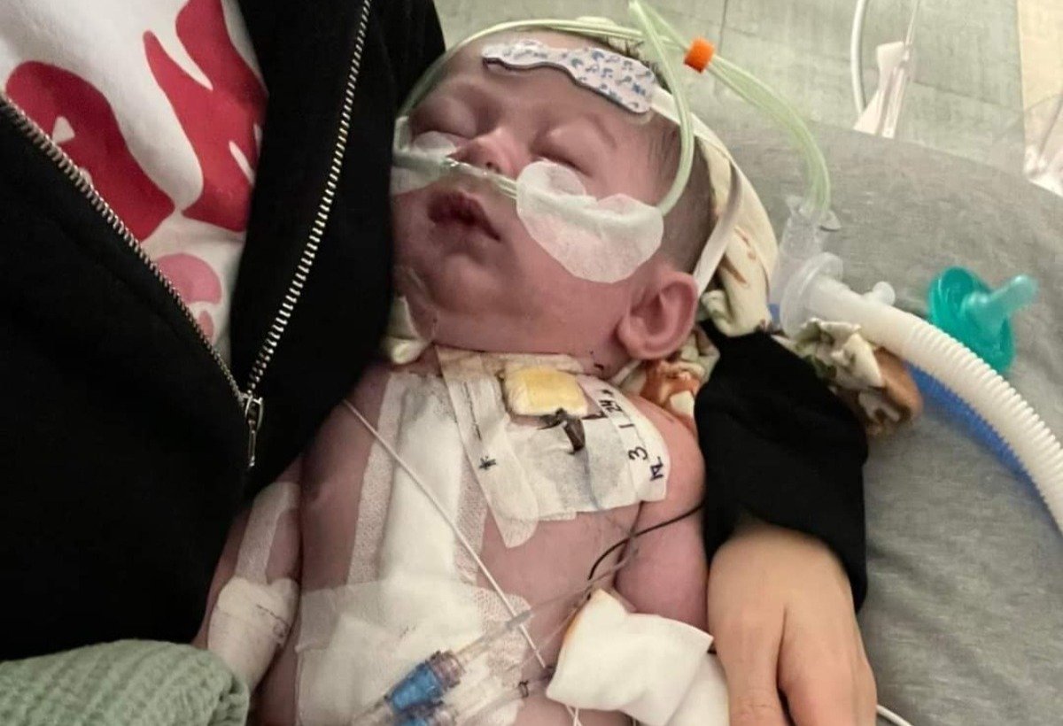 Baby Bowen — heart warrior